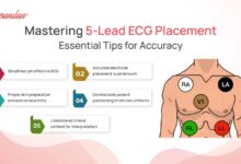 leads ecg placement